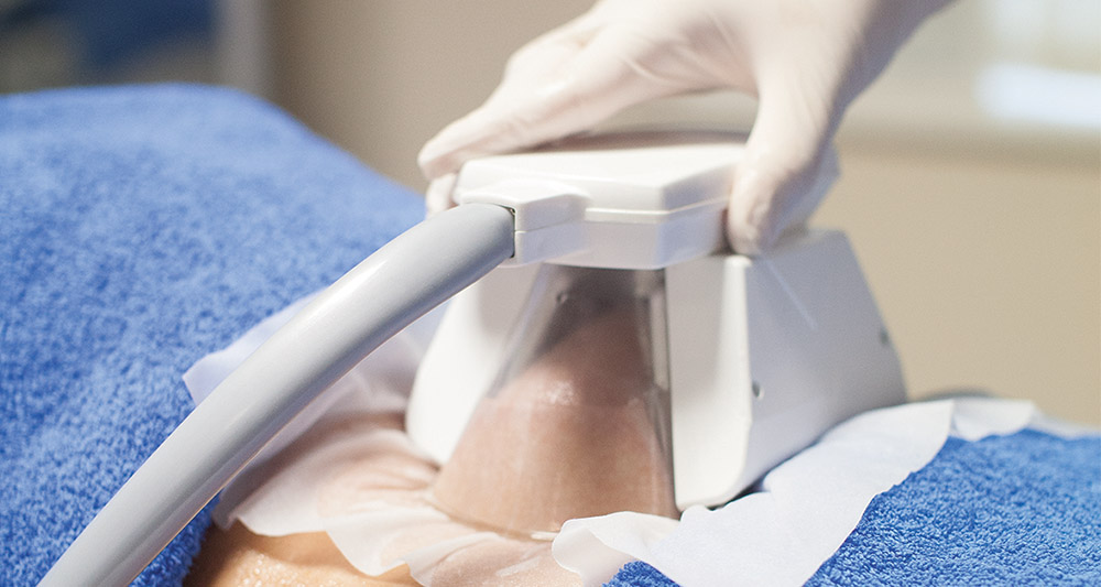 How Fat Freezing and HIFU Work Together? 2 Multiple Areas in One Session HIFU and Fat Freezing Canvey Island