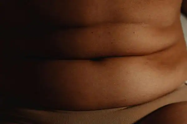 The Hidden Connection: How Stress Shapes Your Fitness and Body Composition 3 image of what stress can do on the stomach area and how Lipo 360 Canvey Island can help to change your body shape.